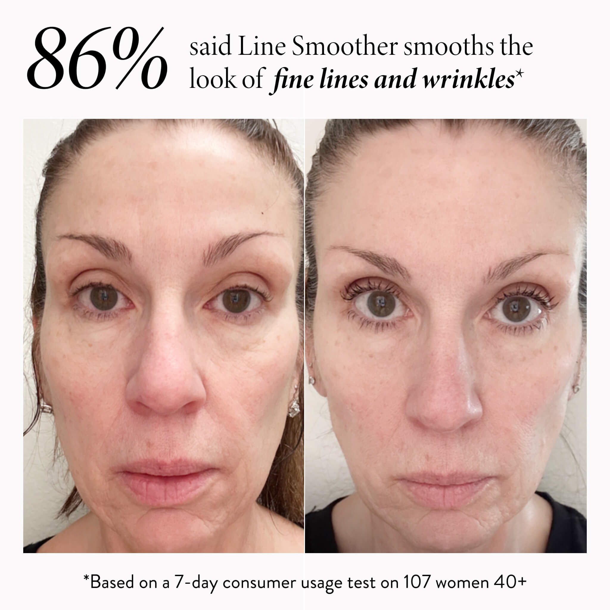 Line Smoother Full Face Kit (3PC)